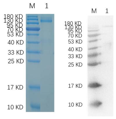 Reducing 12% SDS-PAGE and WB analysis profile of purified IGF1R-01C.